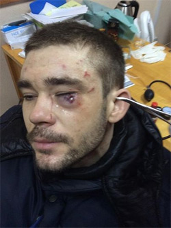 Після зіткнень на Грушевського чотирьом постраждалим видалили очі, ще одному - вибухом відірвало руку